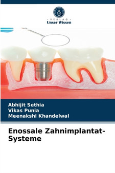 Enossale Zahnimplantat-Systeme by Abhijit Sethia - Paperback