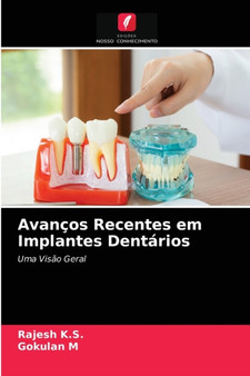 Avancos Recentes em Implantes Dentarios by Rajesh K S - Paperback