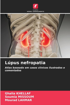 Lupus nefropatia by Ghalia Khellaf - Paperback