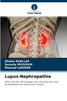 Lupus-Nephropathie by Ghalia Khellaf - Paperback