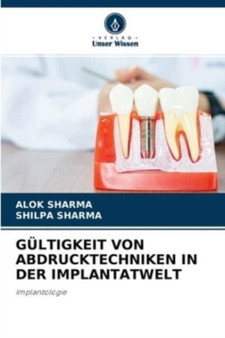 Gultigkeit Von Abdrucktechniken in Der Implantatwelt by Alok Sharma - Paperback