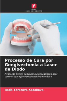 Processo de Cura por Gengivectomia a Laser de Diodo by Rada Torezova Kazakova - Paperback