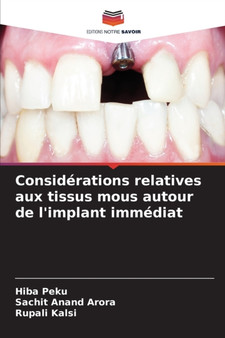 Considerations relatives aux tissus mous autour de l'implant immediat by Hiba Peku - Paperback