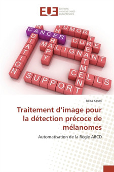 Traitement D Image Pour La Detection Precoce de Melanomes by Kasmi-R - Paperback