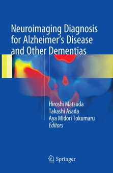 Neuroimaging Diagnosis for Alzheimer's Disease and Other Dementias by Hiroshi Matsuda - Paperback