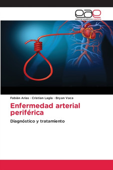 Enfermedad arterial periferica by Fabian Arias - Paperback