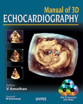 Manual of 3D Echocardiography by V Amuthan - Hardback