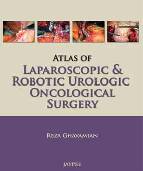Atlas of Laparoscopic and Robotic Urologic Oncological Surgery by Reza Ghavamian - Paperback