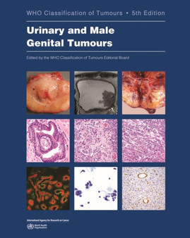 WHO classification of tumours of the urinary system and male genital organs by International Agency for Research on Cancer - Paperback