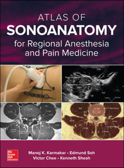 Atlas of Sonoanatomy for Regional Anesthesia and Pain Medicine by Manoj Karmakar - Hardback