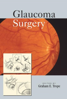 Glaucoma Surgery by Graham E. Trope - Hardback