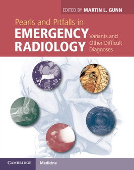 Pearls and Pitfalls in Emergency Radiology : Variants and Other Difficult Diagnoses by Martin L. Gunn - Hardback