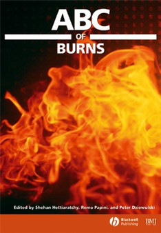 ABC of Burns by Shehan Hettiaratchy - Paperback
