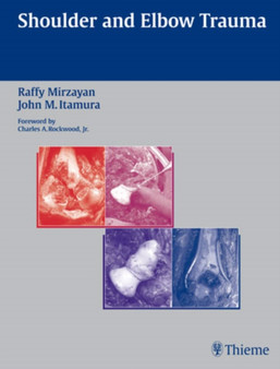 Shoulder and Elbow Trauma by Raffy Mirzayan - Hardback