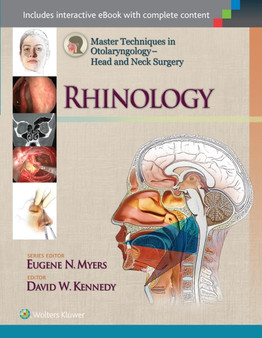 Master Techniques in Otolaryngology - Head and Neck Surgery: Rhinology by David Kennedy - Hardback Master Techniques in Otolaryngology - Head and Neck Surgery: Rhinology by David Kennedy - Hardback