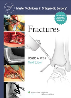 Master Techniques in Orthopaedic Surgery: Fractures by Donald MD Wiss - Hardback