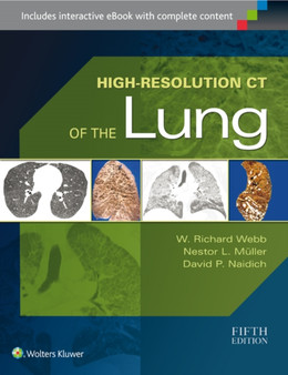 High-Resolution CT of the Lung by W.Richard Webb - Hardback