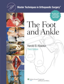Master Techniques in Orthopaedic Surgery: The Foot and Ankle by Harold MD Kitaoka - Hardback