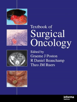 Textbook of Surgical Oncology by Graeme J. Poston - Hardback