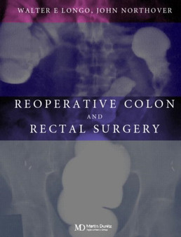 Reoperative Colon and Rectal Surgery by Walter Longo - Hardback