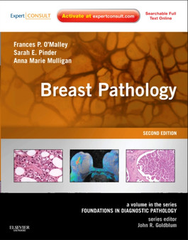Breast Pathology : A Volume in the Series: Foundations in Diagnostic Pathology by Frances P. O'Malley - Hardback