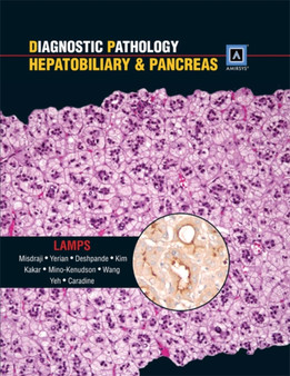 Diagnostic Pathology: Hepatobiliary & Pancreas : Published by Amirsys by Laura MD Lamps - Hardback