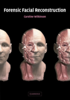 Forensic Facial Reconstruction by Caroline Wilkinson - Paperback
