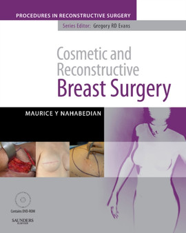 Cosmetic and Reconstructive Breast Surgery with DVD : A Volume in The Procedures in Reconstructive Surgery Series by Maurice Y MD FACS Nahabedian - Hardback