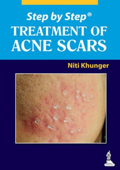 Step by Step: Treatment of Acne Scars by Niti Khunger - Paperback