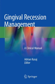 Gingival Recession Management : A Clinical Manual by Adrian Kasaj - Paperback