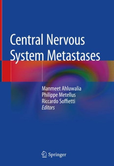 Central Nervous System Metastases by Manmeet Ahluwalia - Hardback
