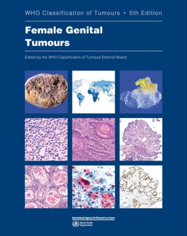 WHO classification of female genital tumours : 4 by International Agency for Research on Cancer - Paperback