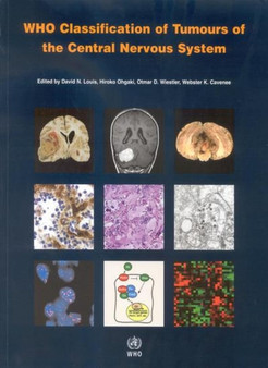WHO Classification of Tumours of the Central Nervous System : WHO Classification of Tumours Volume 1 : No. 1 by International Agency for Research on Cancer - Paperback