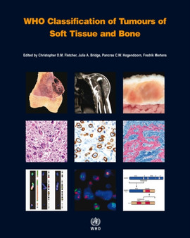 WHO classification of tumours of soft tissue and bone : 5 by International Agency for Research on Cancer - Paperback