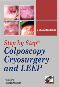 Step-by-Step Colposcopy, Cryosurgery, and LEEP by B Baliga - Paperback