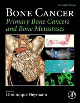 Bone Cancer : Primary Bone Cancers and Bone Metastases by Dominique Heymann - Paperback