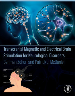 Transcranial Magnetic and Electrical Brain Stimulation for Neurological Disorders by Bahman Zohuri - Paperback