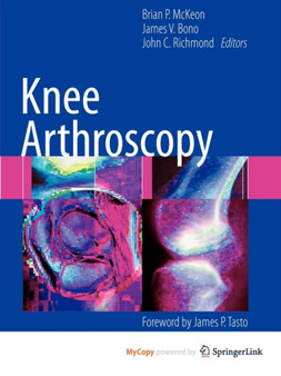 Knee Arthroscopy by Brian P. McKeon - Paperback