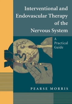 Interventional and Endovascular Therapy of the Nervous System : A Practical Guide by Pearse Morris - Hardback
