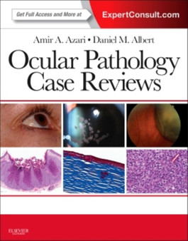 Ocular Pathology Case Reviews : Expert Consult - Online and Print by Amir A. Azari - Paperback