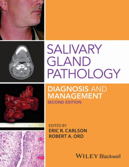 Salivary Gland Pathology : Diagnosis and Management by Robert A. Ord - Hardback