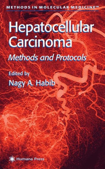 Hepatocellular Carcinoma : Methods and Protocols : 45 by Nagy A. Habib - Hardback