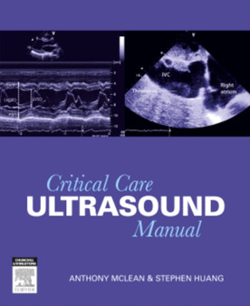 Critical Care Ultrasound Manual by Anthony McLean - Paperback