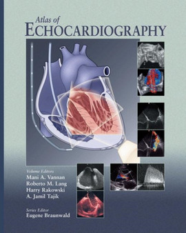 Atlas of Echocardiography by Mani A. Vannan - Hardback
