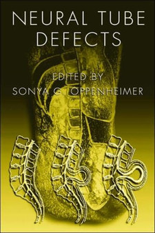 Neural Tube Defects by Sonya G. Oppenheimer - Hardback