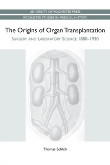 The Origins of Organ Transplantation : Surgery and Laboratory Science, 1880-1930 by Thomas Schlich - Paperback