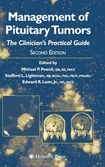Management of Pituitary Tumors : The Clinician's Practical Guide by Michael P. Powell - Hardback