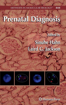 Prenatal Diagnosis : 444 by Sinuhe Hahn - Hardback