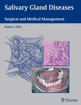 Salivary Gland Diseases : Surgical and Medical Management by Robert L. Witt - Hardback