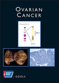 OVARIAN CANCER by OZOLS - Hardback